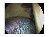Laparoscopic view of a horse's spleen...