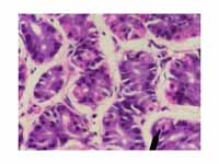 Human parietal cells - stomach