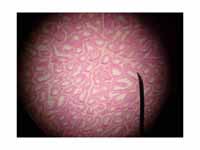 microscopic picture of seminiferous t...