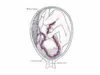Fetus in utero, between fifth and six...